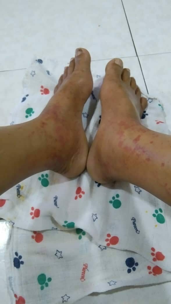 Telan Panadol Setiap Empat Jam Sebab Penyakit “Misteri”